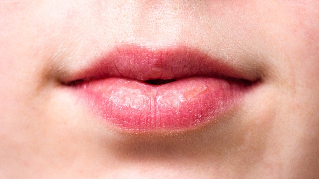 Герпес на губах: медикаментозное и народное лечение