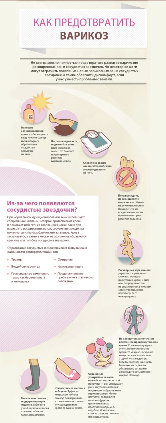 Профилактика варикоза