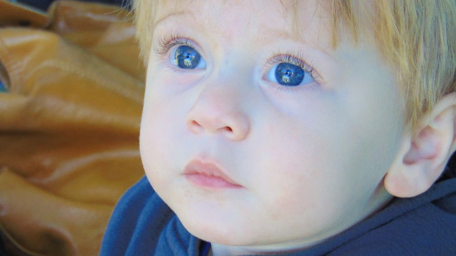 Как своевременно диагностировать «ленивый» глаз у ребенка, и уберечь его от серьезных последствий