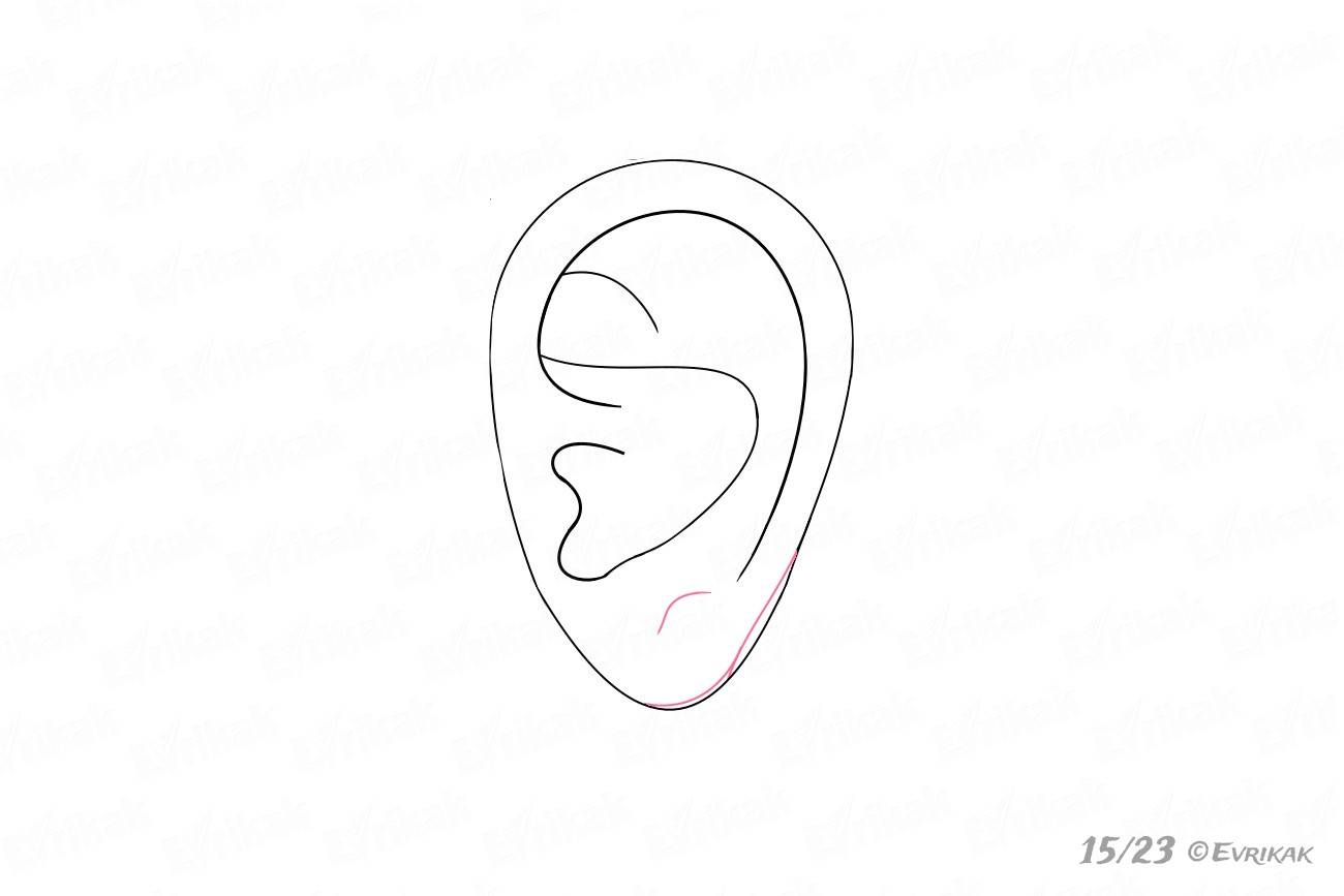 Придание правильной формы уха