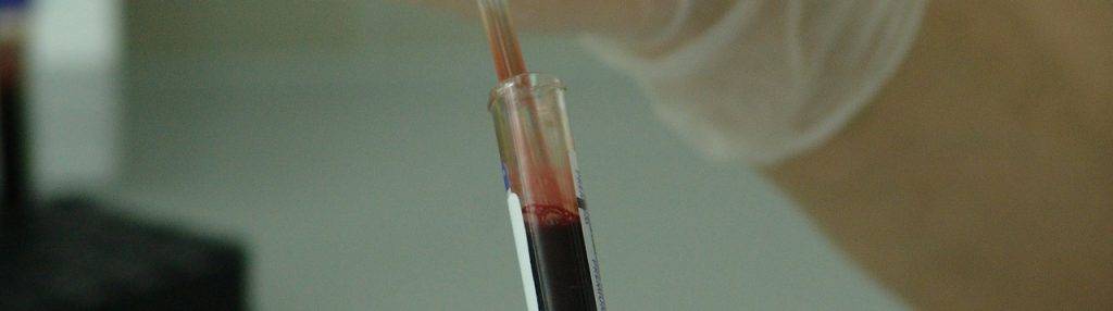 Переливание крови: кто может быть донором, процесс и правила процедуры