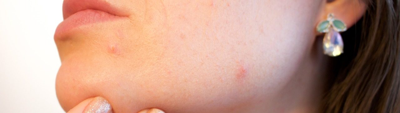 Почему на теле появляются красные точки и как их лечить