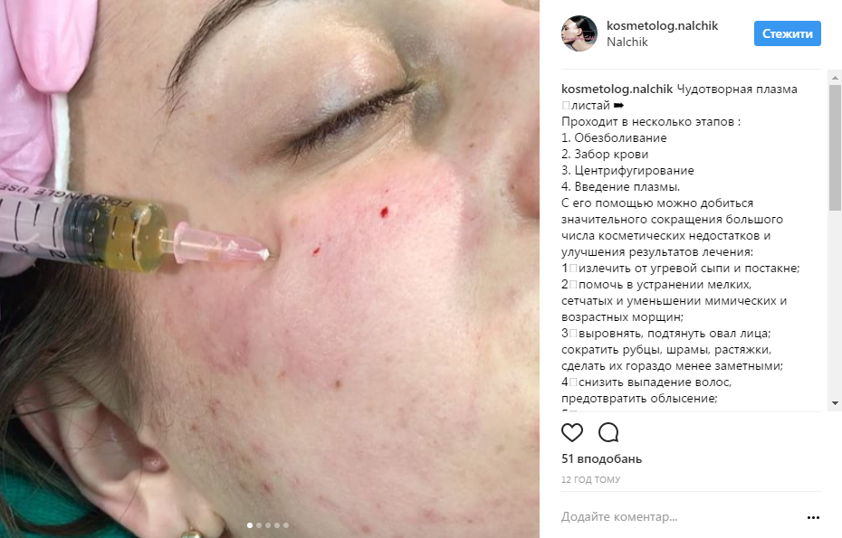 instagram.com/kosmetolog.nalchik/