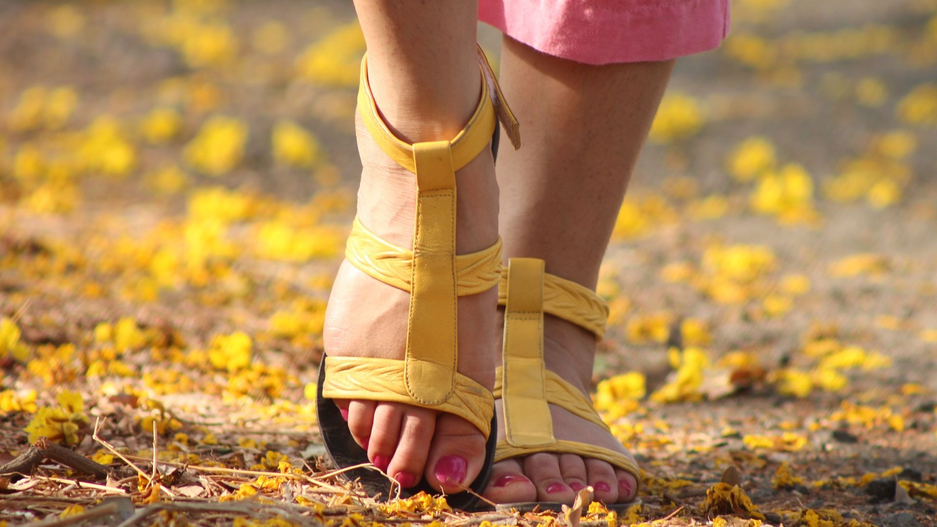 Как вылечить шишки на ногах: ортопедическая обувь, стельки, шины, бандажи